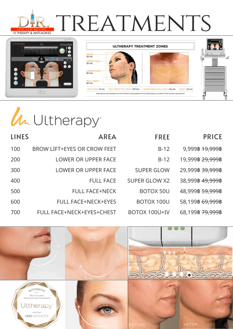 ULTHERAPY