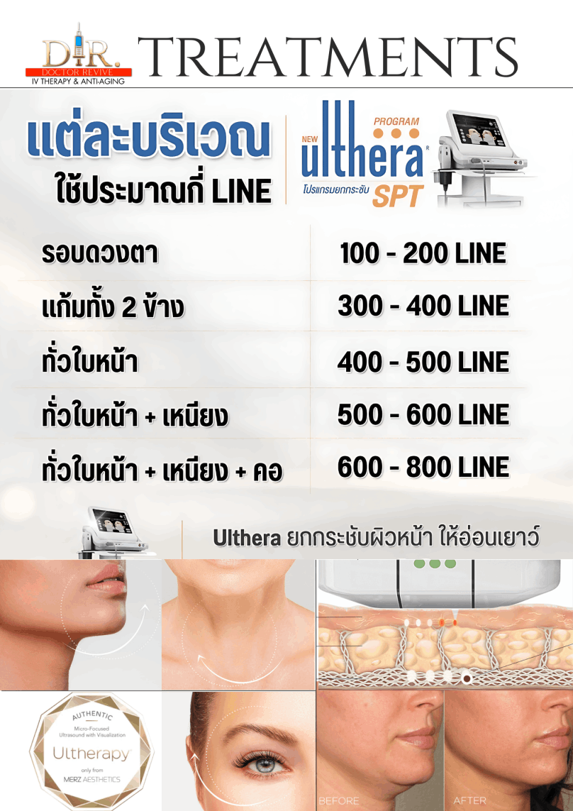 Ultherapy ใช้ประมาณกี่ Lines